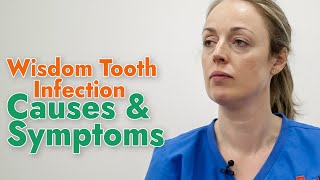 Causes And Symptoms Of Wisdom Tooth Infection  Dr Anna Beattie  3Dental [upl. by Eatton]