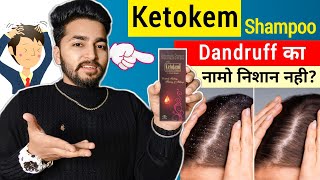 Ketokem Shampoo Review  Ketokem Anti Dandruff Shampoo [upl. by Ev]