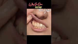 shorts Why Do Our Teeth Turn Yellow🤔 facts information knowledge [upl. by Topping971]