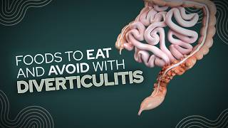 Foods To Eat and Avoid With Diverticulitis [upl. by Ahsinauq116]