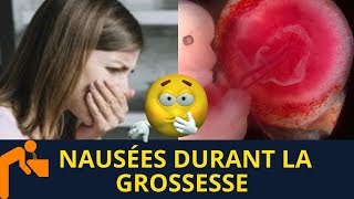 Nausées durant la grossesse  Un bon signe [upl. by Hartfield]