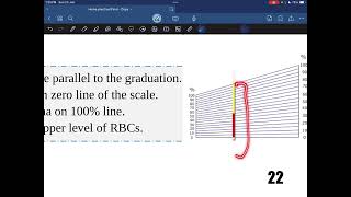 Hematocrit value  Practical hematology  Dr Saiko [upl. by Hedvig]