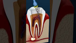 Cavity filling dentist teeth anatomy neet usmlestep [upl. by Eniamirt]