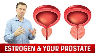 How To Fix Enlarged Prostate Explained By Dr Berg [upl. by Attolrahc]