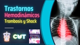 Emisión en directo  Trastornos hemodinámicos trombosis y shock  Curso 2023B [upl. by Girish]