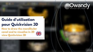 3 How to draw the mandibular canal and to visualise in 3D view Quickvision 3D [upl. by Yaniv]