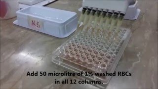 AJs Science 2 How to perform Hemagglutination assay HA Test [upl. by Adliw]