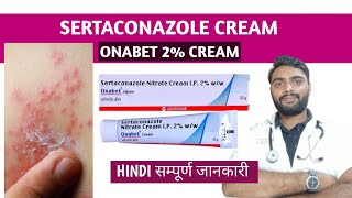 Sertaconazole cream in hindi  Onabet cream  Sertaconazole ointment [upl. by Ettennad]