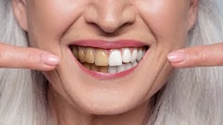 11 Natural Ways to Whiten Teeth at Any Age [upl. by Elleinwad]