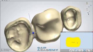 How to Design Bridge Connectors and Anatomical Copings with 3Shape Dental System [upl. by Enyad]