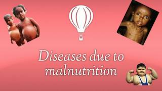 Diseases due to malnutrition10th class [upl. by Packton]