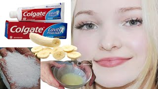 Mix banana and toothpaste Skin whitening recipe skincare [upl. by Okram23]