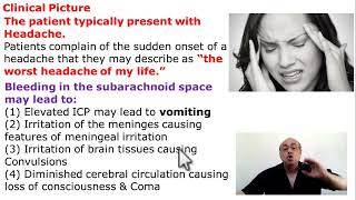 Subarachnoid Hemorrhage [upl. by Rollet]