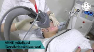 AKNE müalicəsi səpgilərin sterilizasiyası [upl. by Colwin]