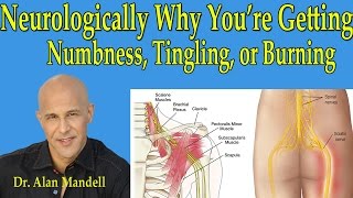 Neurologically Why Youre Getting NumbnessTingling or Burning in Arms or Legs  Dr Mandell [upl. by Ann-Marie]