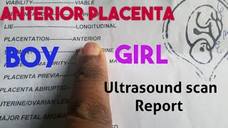 Anterior Placenta Baby GenderUltrasound Scan Report [upl. by Asusej]