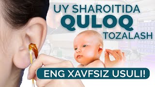 Quloqni uy sharoitida tozalash Eng xavfsiz usul LOR qabuli 95 1888688 [upl. by Joela]