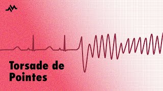 Torsade de Pointes  EKG ECG Interpretation [upl. by Darnell]