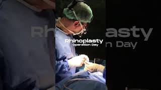 Rhinoplasty I Estetik International [upl. by Kitti52]