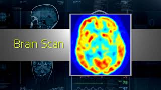 Understanding Nuclear Medicine [upl. by Ellehcen449]