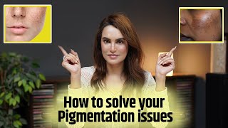 Get Rid of Skin Pigmentation  Nadia Hussain  Official HD [upl. by Devlin]