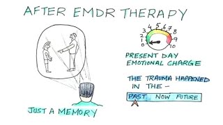 What is EMDR Therapy How it Works and Who can Benefit from it [upl. by Mialliw39]