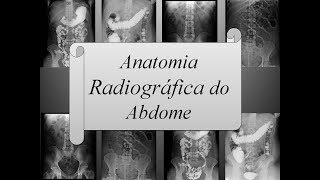 Anatomia Radiográfica do Abdome [upl. by Hiroshi448]