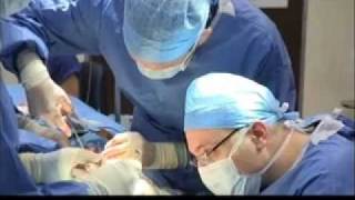 1st  2nd stages Ear reconstruction in microtia  Dr Greg OToole  Dr Walid Sabbagh [upl. by Wolpert]