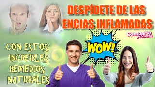 💥ENCIAS INFLAMADAS💥 Remedios CaserosDespídete de las ENCIAS INFLAMADAS Rápido con estos consejos💚 [upl. by Aliahs]