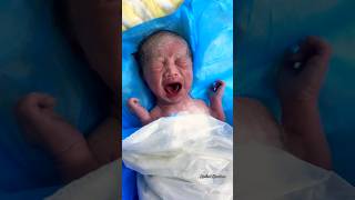 New Born 👶 newborn neonatal baby babycrying babies shorts satisfying [upl. by Anialahs]