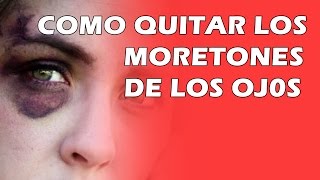 Como Quitar Los Moretones De Los Ojos [upl. by Mccall]