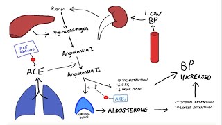 Glomerulonephritis Part2 [upl. by Natie]