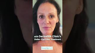 Brighten and Refresh Your Look with DermaSilk Clinic’s UnderEye Filler Treatment [upl. by Athelstan]