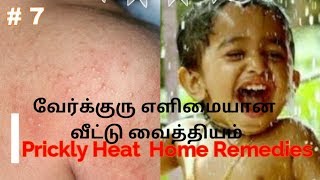 Verkuru Neengapoga Simple Home Remedies in Tamil  Treatment Tips for Prickly Heat in Tamil [upl. by Haydon148]