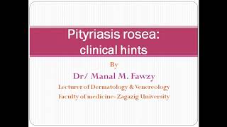 Pityriasis rosea clinical hints [upl. by Berman]