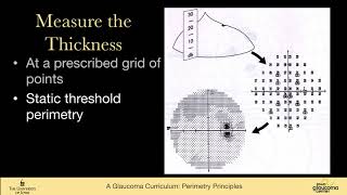 Perimetry principles types of perimetry Kinetic static threshold SWAP FDT [upl. by Anale]