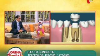 La Endodoncia y su Complicaciones [upl. by Nylirret]