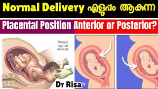 പ്രസവം എളുപ്പമാകുന്ന Placental Position  Anterior amp Posterior Placenta [upl. by Hart]