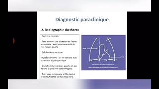 Cours de Cardiologie Rétrécissement Aortique [upl. by Ellehcar]