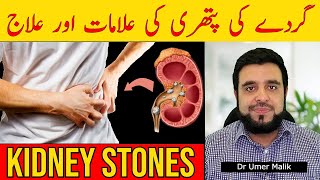 Left Arm Pain 6 Causes In Urdu Baayan Bazoo Main Dard Ki Waja Dil Ke Dore Ki Alamat [upl. by Estel]