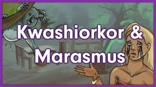 Kwashiorkor vs Marasmus  Nutrition Mnemonic [upl. by Ahsoet]