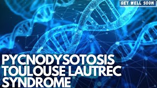 Pycnodysostosis Toulouse Lautrec Syndrome [upl. by Cutcheon852]