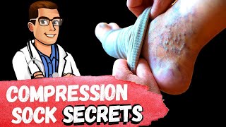 BEST Compression Socks TIPS How To Fix Swollen Feet Ankles amp Legs [upl. by Chaille]