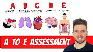 A to E Assessment for Deteriorating and Acutely Unwell Patients  ABDCE Clinical Approach [upl. by Ladnik635]