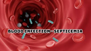 SEPSIS PATHOPHYSIOLOGY OF SEPTICEMIA [upl. by Malcah150]