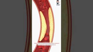 Top 5 Medications That Impact Blood Glucose Levels  Diabetes Management Insights [upl. by Alden164]