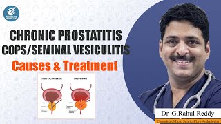 Chronic Prostatitis CopsSeminal Vesiculitis Causes amp Treatment  Rahul Reddy  Androcare Andrology [upl. by Snej175]