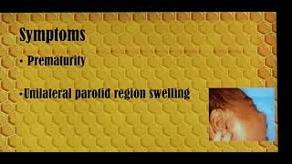 Acute parotitis in neonates Patient teaching programme Tamil [upl. by Nady]