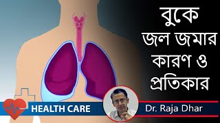 Pleural Effusions Causes Symptoms Treatment বুকে জল জমার লক্ষণ ও কারণ  Pulmonologist Dr Raja Dhar [upl. by Yspyg]