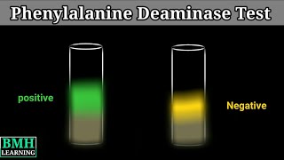 Phenylalanine Deaminase Test [upl. by Cummins25]